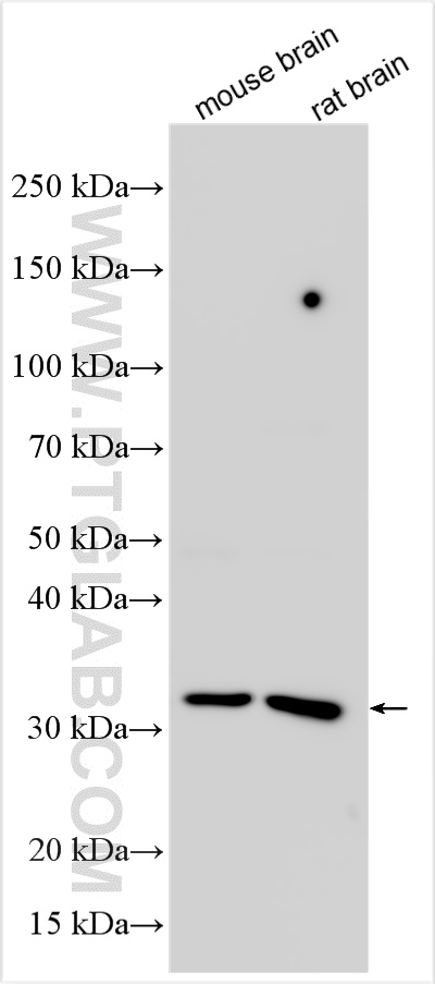 SLC25A36