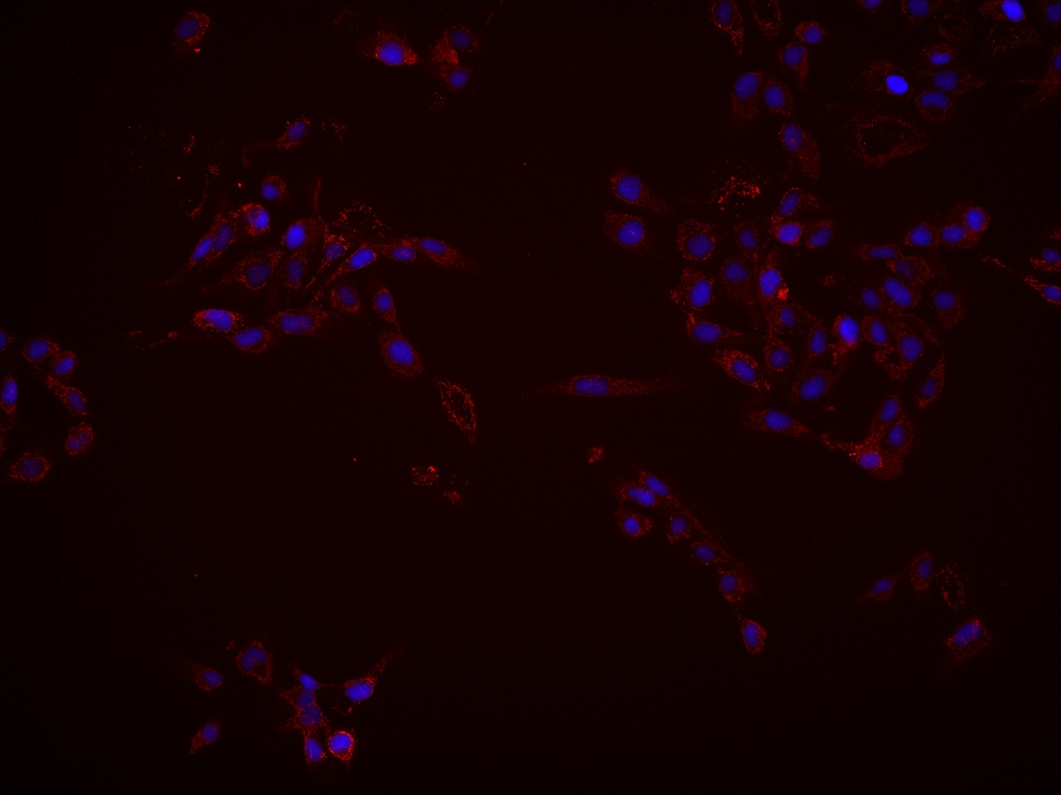 Immunofluorescence (IF) / fluorescent staining of A431 cells using SLC25A36 Monoclonal antibody (67896-1-Ig)