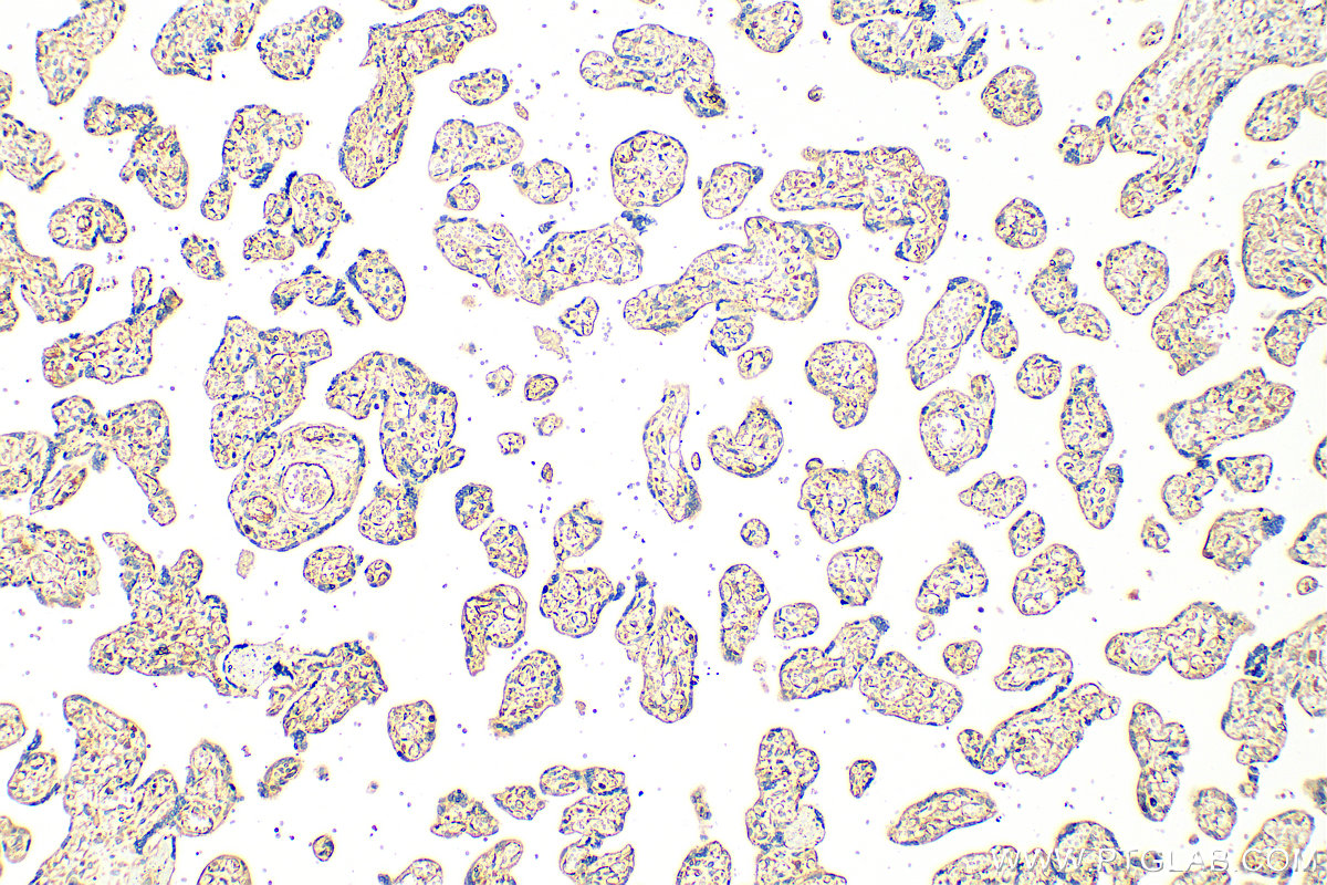 Immunohistochemistry (IHC) staining of human placenta tissue using SLC25A40 Polyclonal antibody (20615-1-AP)