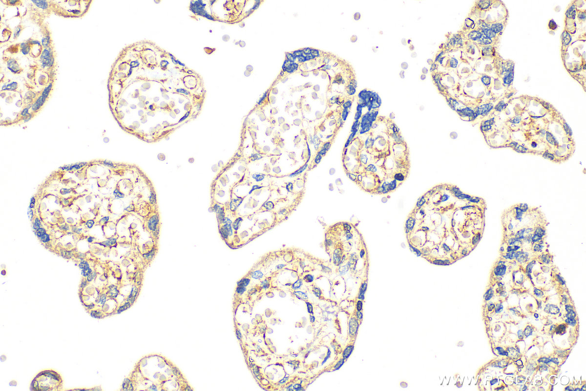 Immunohistochemistry (IHC) staining of human placenta tissue using SLC25A40 Polyclonal antibody (20615-1-AP)