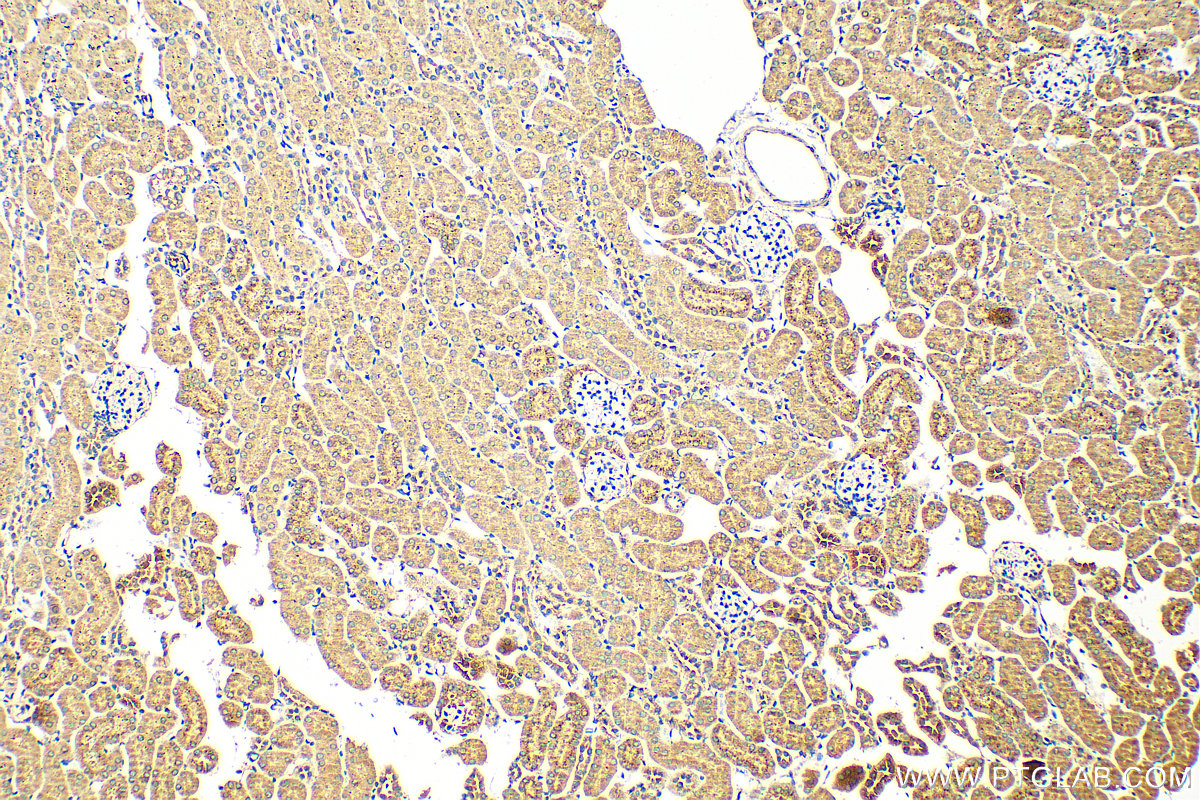 Immunohistochemistry (IHC) staining of mouse kidney tissue using SLC25A40 Polyclonal antibody (20615-1-AP)