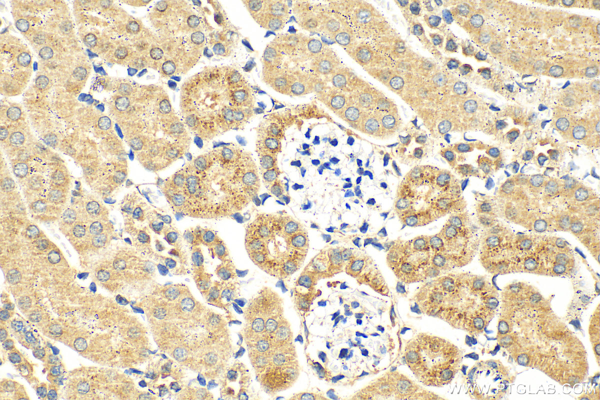 Immunohistochemistry (IHC) staining of mouse kidney tissue using SLC25A40 Polyclonal antibody (20615-1-AP)