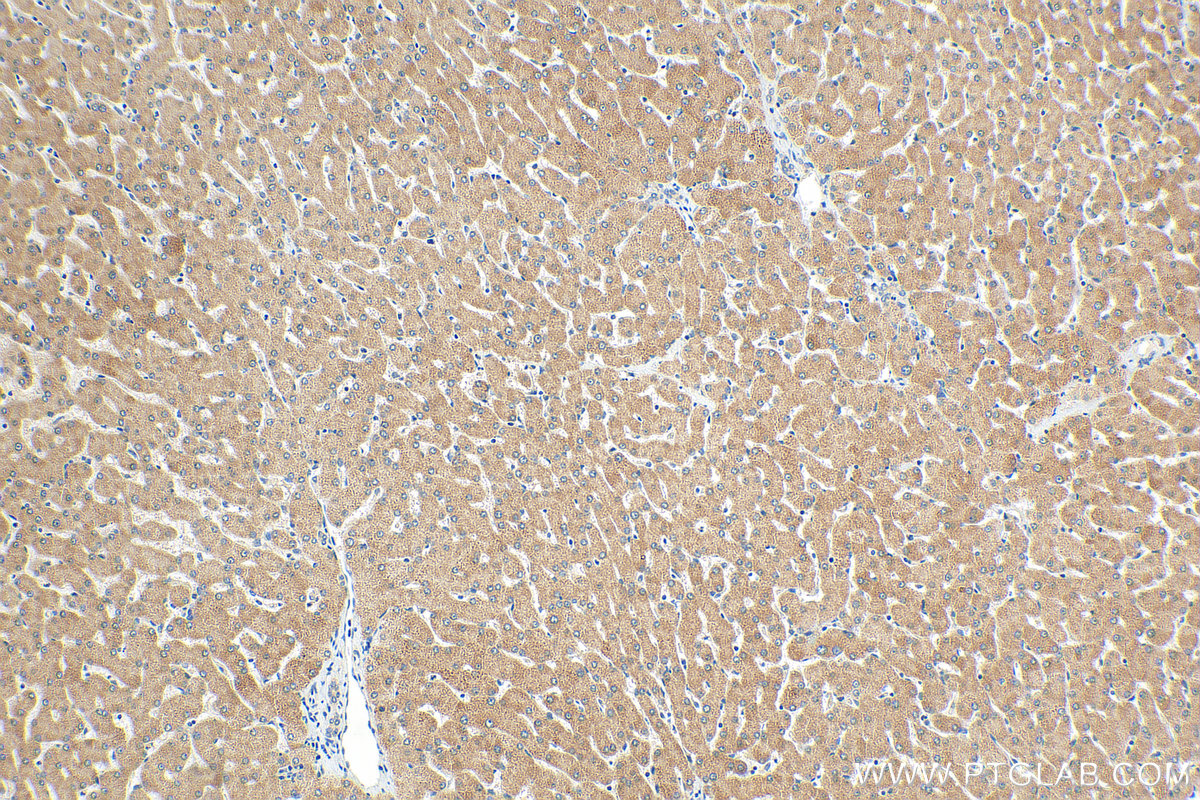 Immunohistochemistry (IHC) staining of human liver tissue using SLC25A41 Polyclonal antibody (17437-1-AP)
