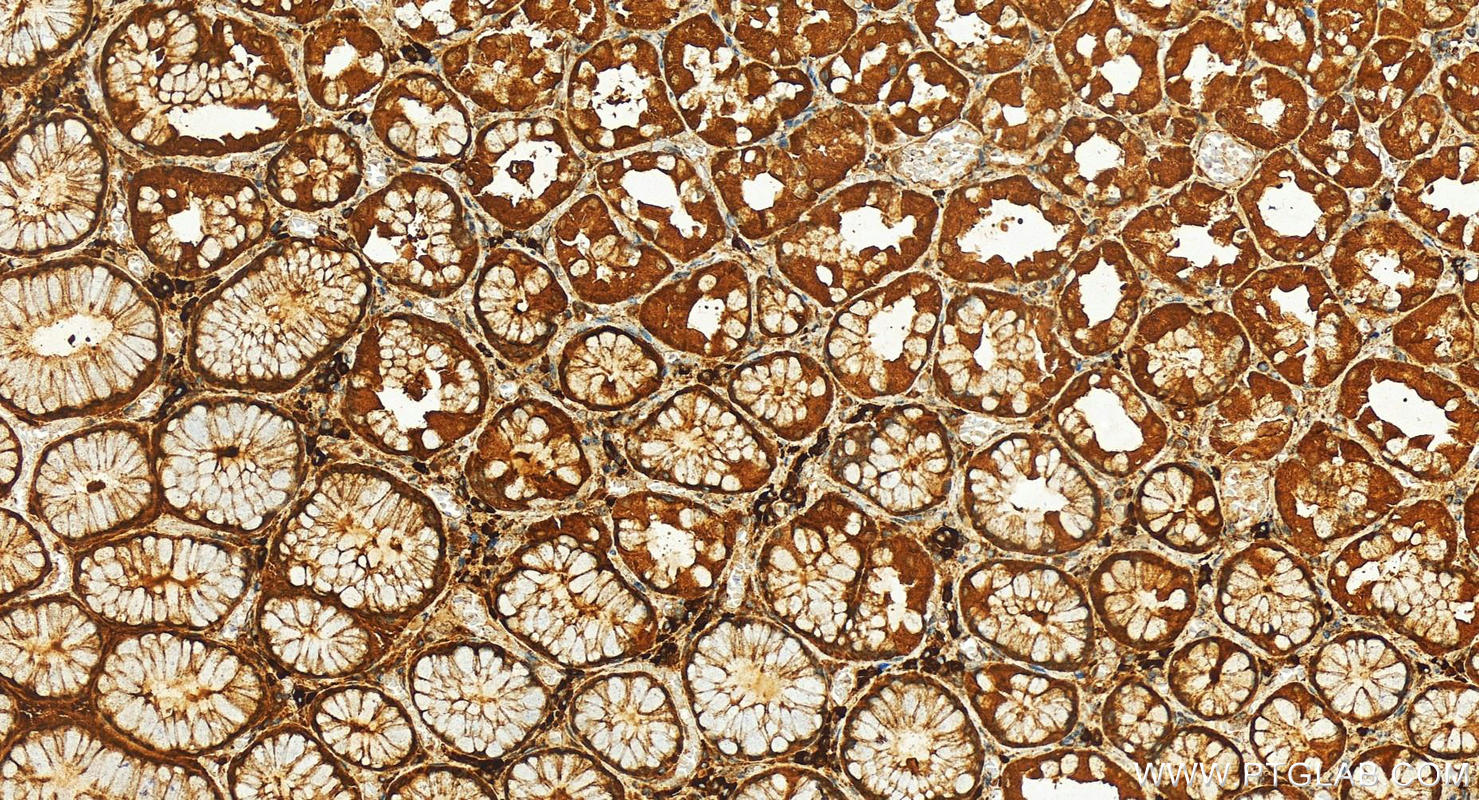 Immunohistochemistry (IHC) staining of human stomach tissue using SLC25A46 Polyclonal antibody (12277-1-AP)