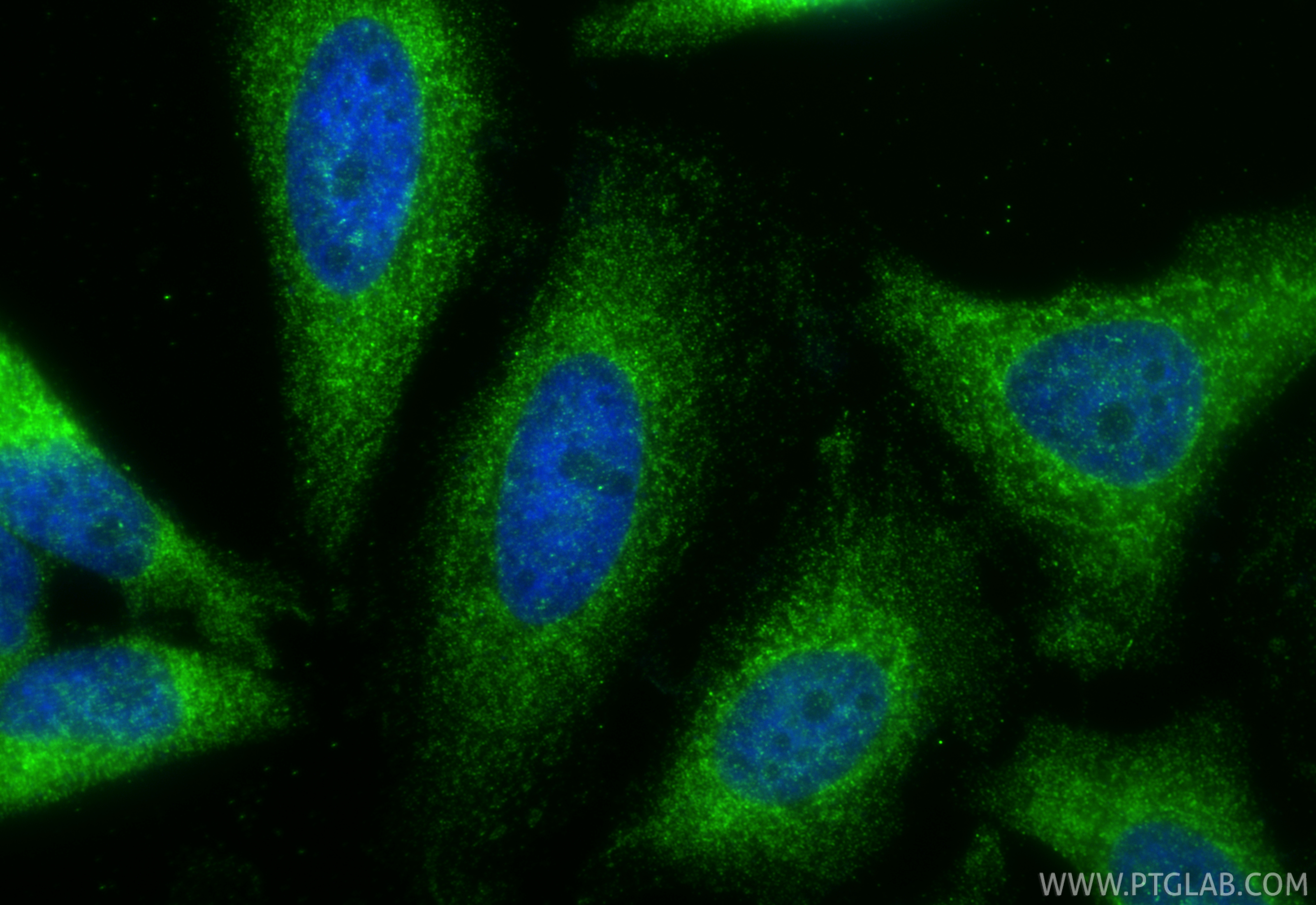 Immunofluorescence (IF) / fluorescent staining of HeLa cells using SLC25A46 Polyclonal antibody (12277-1-AP)