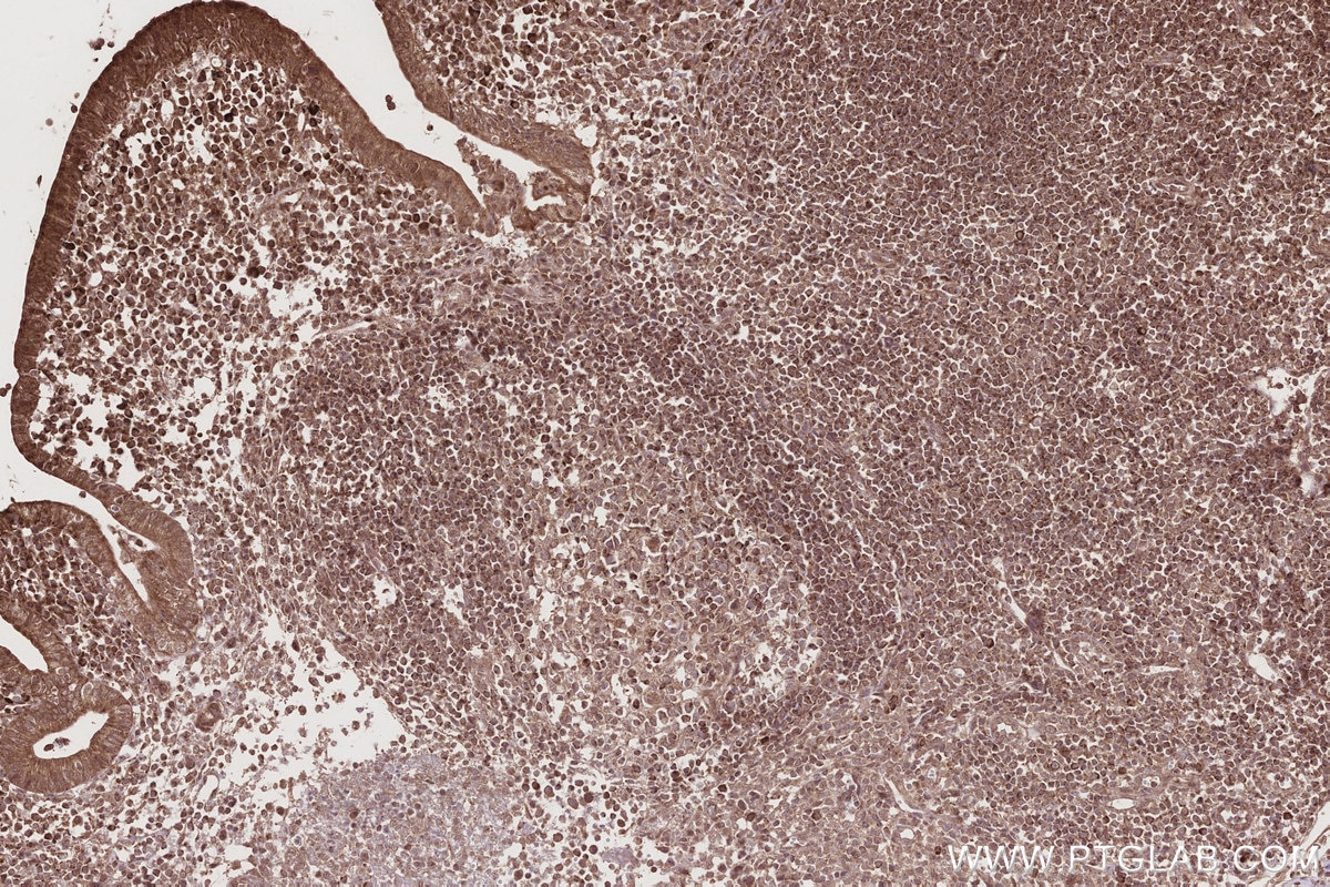 Immunohistochemistry (IHC) staining of human appendicitis tissue using SLC25A46 Polyclonal antibody (12277-1-AP)