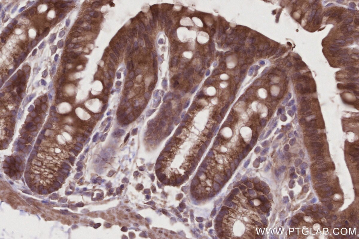 Immunohistochemistry (IHC) staining of mouse colon tissue using SLC25A46 Polyclonal antibody (12277-1-AP)
