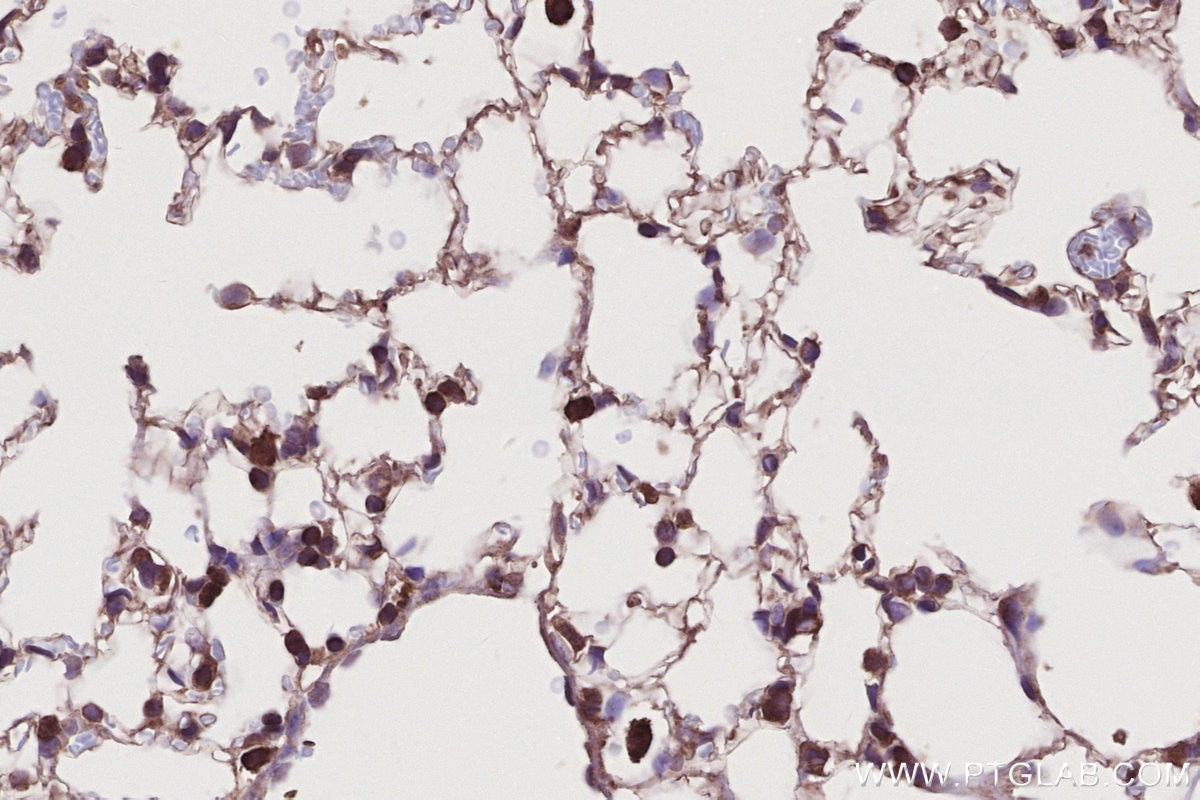 Immunohistochemistry (IHC) staining of mouse lung tissue using SLC25A46 Polyclonal antibody (12277-1-AP)