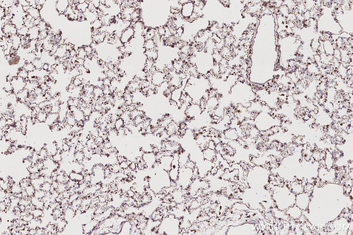 Immunohistochemistry (IHC) staining of rat lung tissue using SLC25A46 Polyclonal antibody (12277-1-AP)