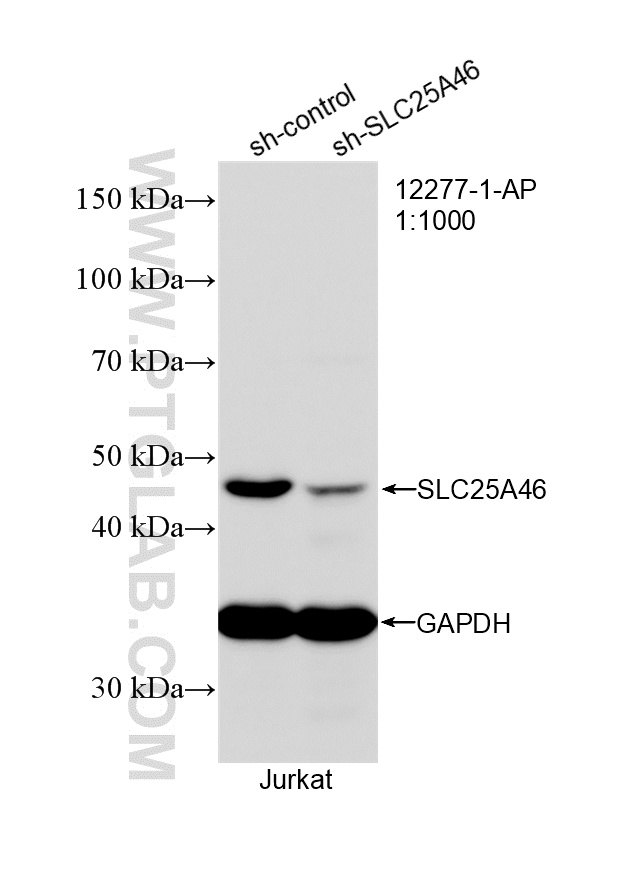 Western Blot (WB) analysis of Jurkat cells using SLC25A46 Polyclonal antibody (12277-1-AP)