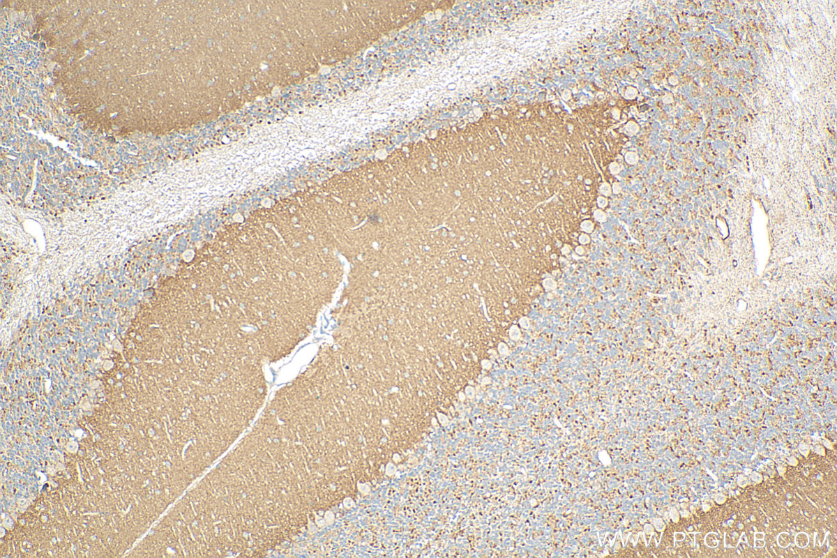 Immunohistochemistry (IHC) staining of mouse cerebellum tissue using SLC26A11 Polyclonal antibody (14156-1-AP)