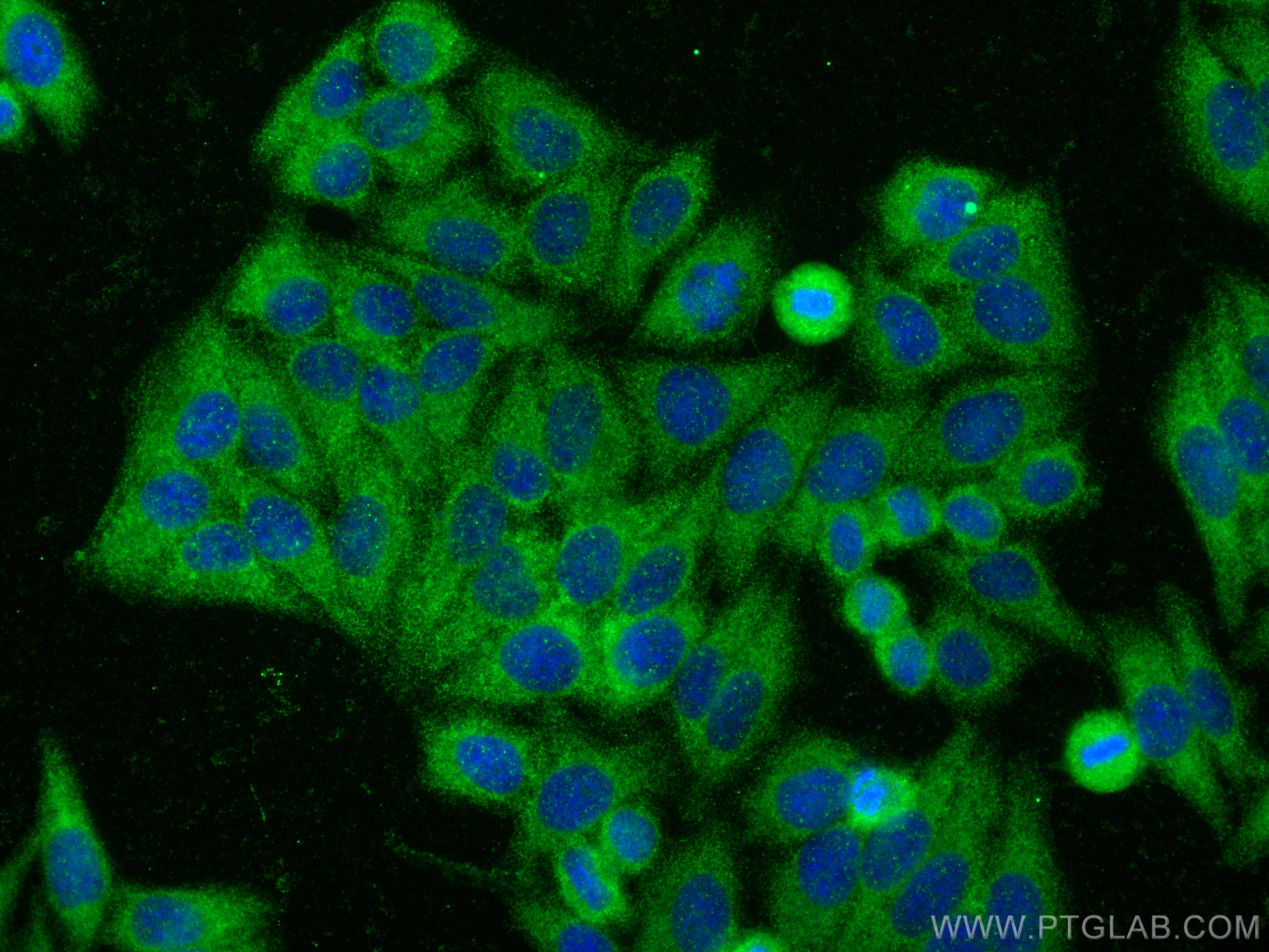 Immunofluorescence (IF) / fluorescent staining of HepG2 cells using SLC26A2 Polyclonal antibody (27759-1-AP)