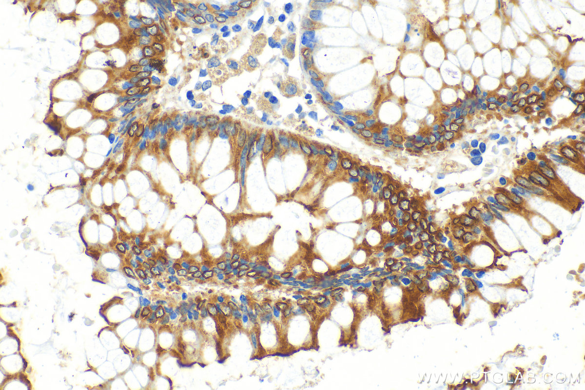 Immunohistochemistry (IHC) staining of human colon tissue using SLC26A3 Polyclonal antibody (13165-1-AP)