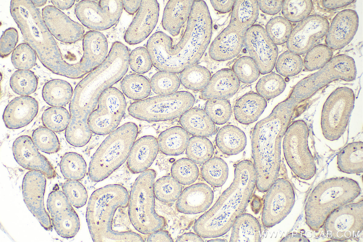 Immunohistochemistry (IHC) staining of mouse testis tissue using SLC26A3 Polyclonal antibody (13165-1-AP)