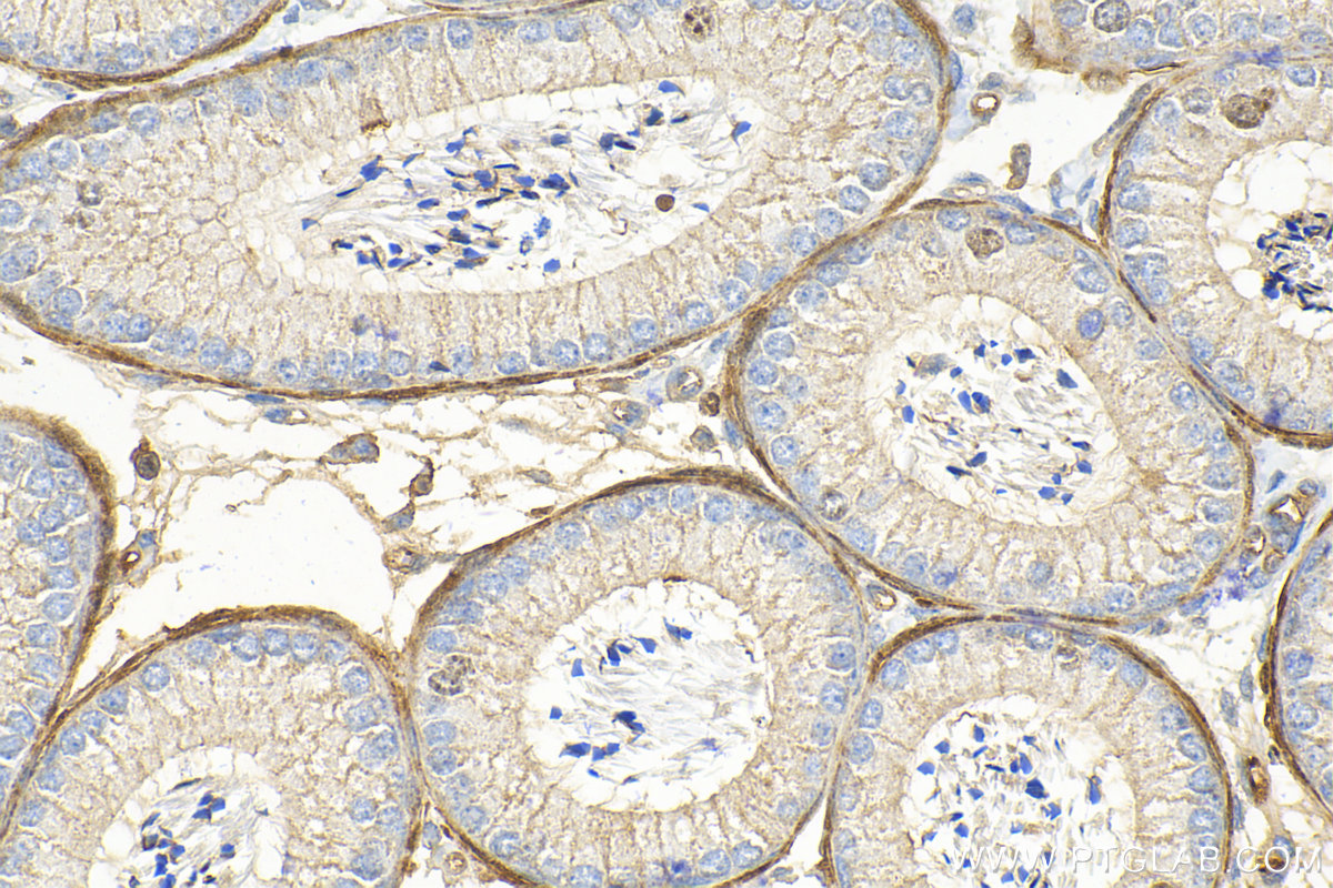 Immunohistochemistry (IHC) staining of mouse testis tissue using SLC26A3 Polyclonal antibody (13165-1-AP)