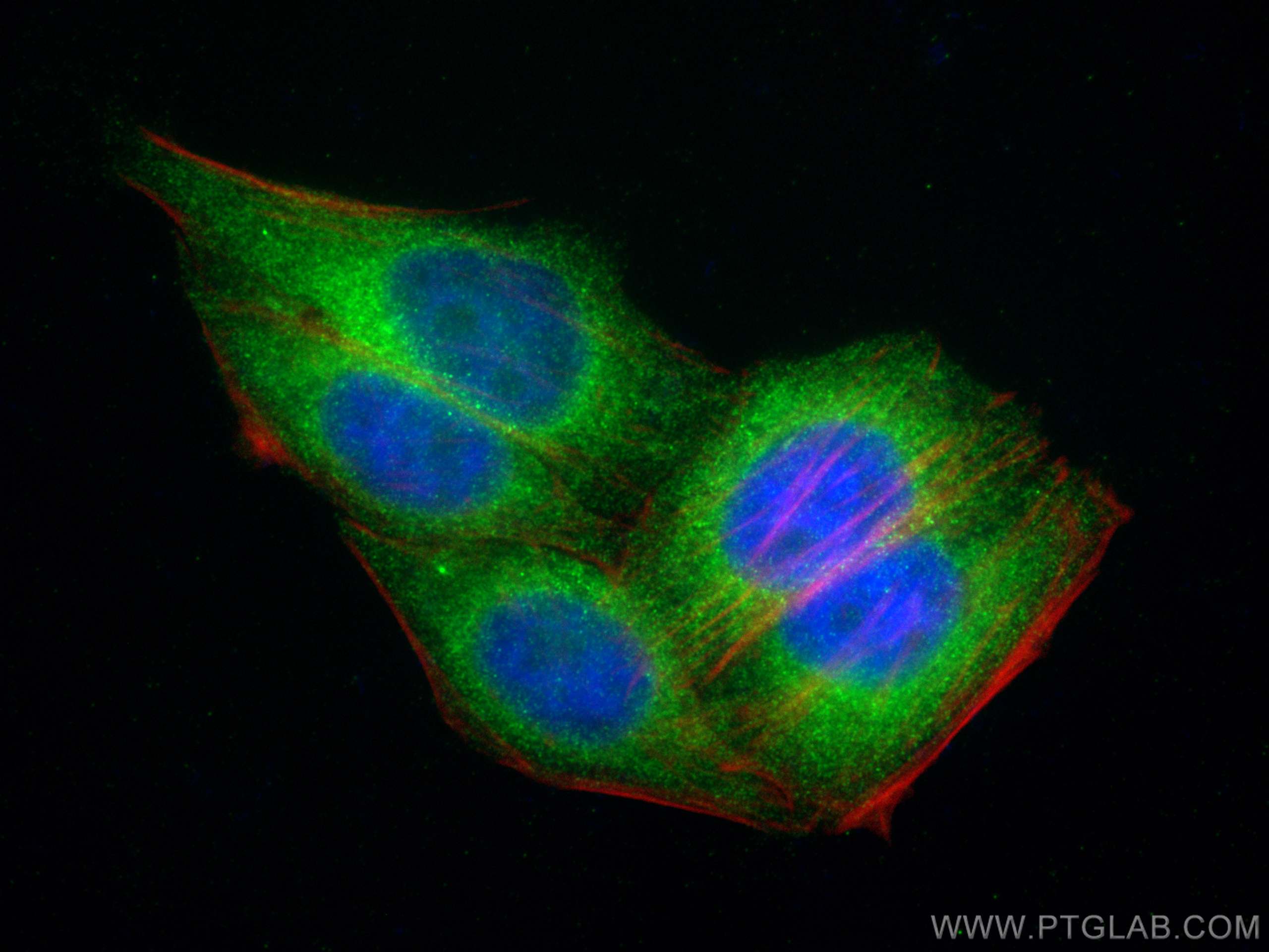 Immunofluorescence (IF) / fluorescent staining of HepG2 cells using FATP2 Polyclonal antibody (14048-1-AP)