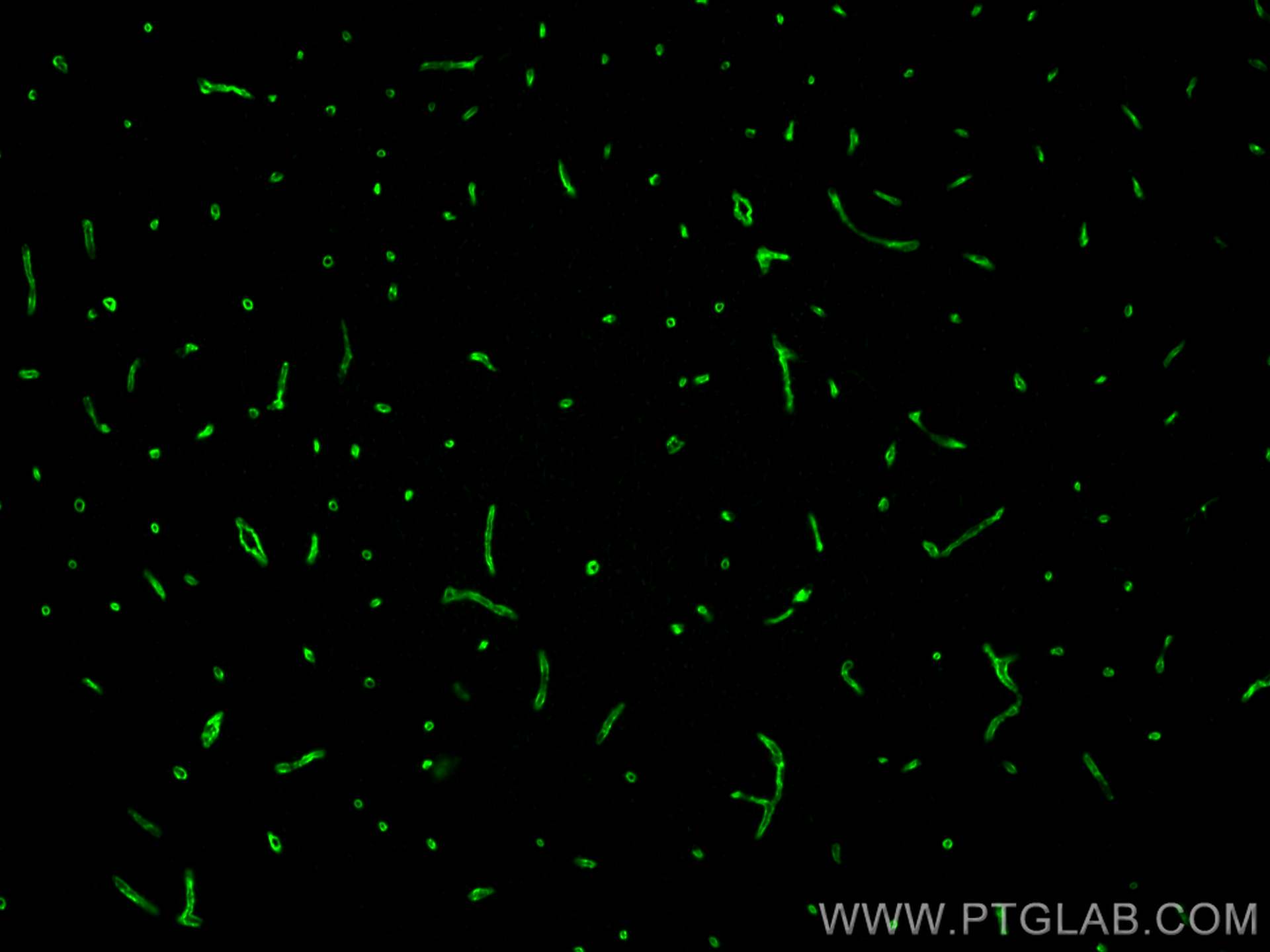 Immunofluorescence (IF) / fluorescent staining of mouse brain tissue using GLUT1 Polyclonal antibody (21829-1-AP)