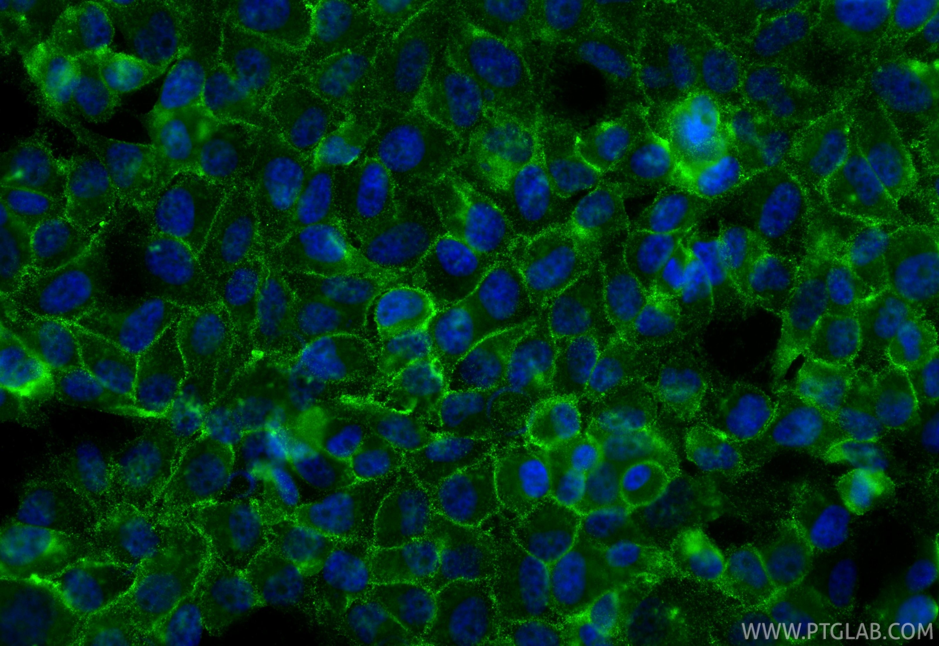 Immunofluorescence (IF) / fluorescent staining of HeLa cells using GLUT1 Polyclonal antibody (21829-1-AP)