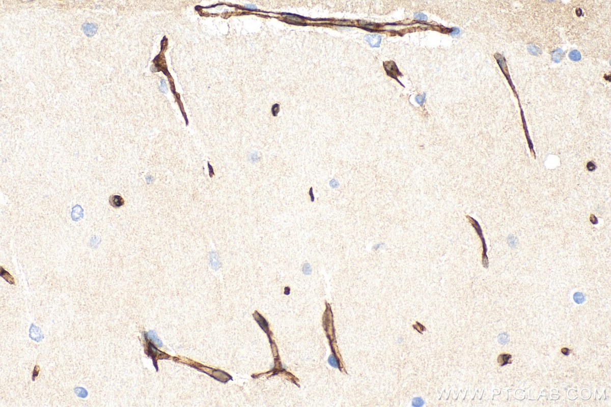 Immunohistochemistry (IHC) staining of rat brain tissue using GLUT1 Polyclonal antibody (21829-1-AP)