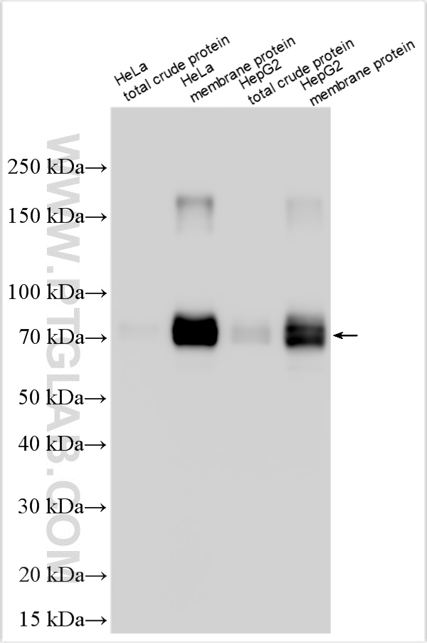 Western Blot (WB) analysis of various lysates using SLC30A1 Polyclonal antibody (22661-1-AP)