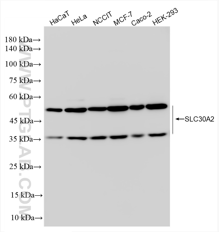 Western Blot (WB) analysis of various lysates using SLC30A2 Recombinant antibody (83666-1-RR)