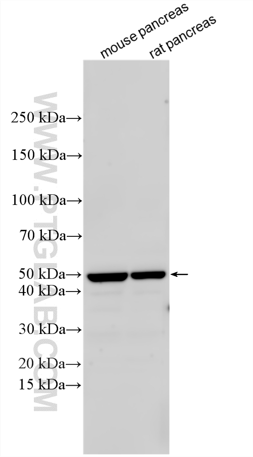 Western Blot (WB) analysis of various lysates using SLC30A8/ZNT8-Specific Polyclonal antibody (16169-1-AP)