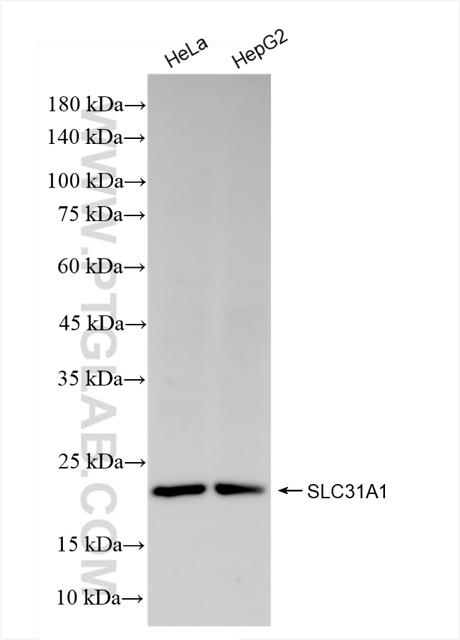 Western Blot (WB) analysis of various lysates using SLC31A1 Recombinant antibody (83844-5-RR)