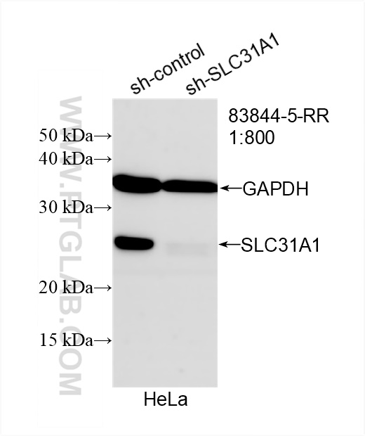 Western Blot (WB) analysis of HeLa cells using SLC31A1 Recombinant antibody (83844-5-RR)