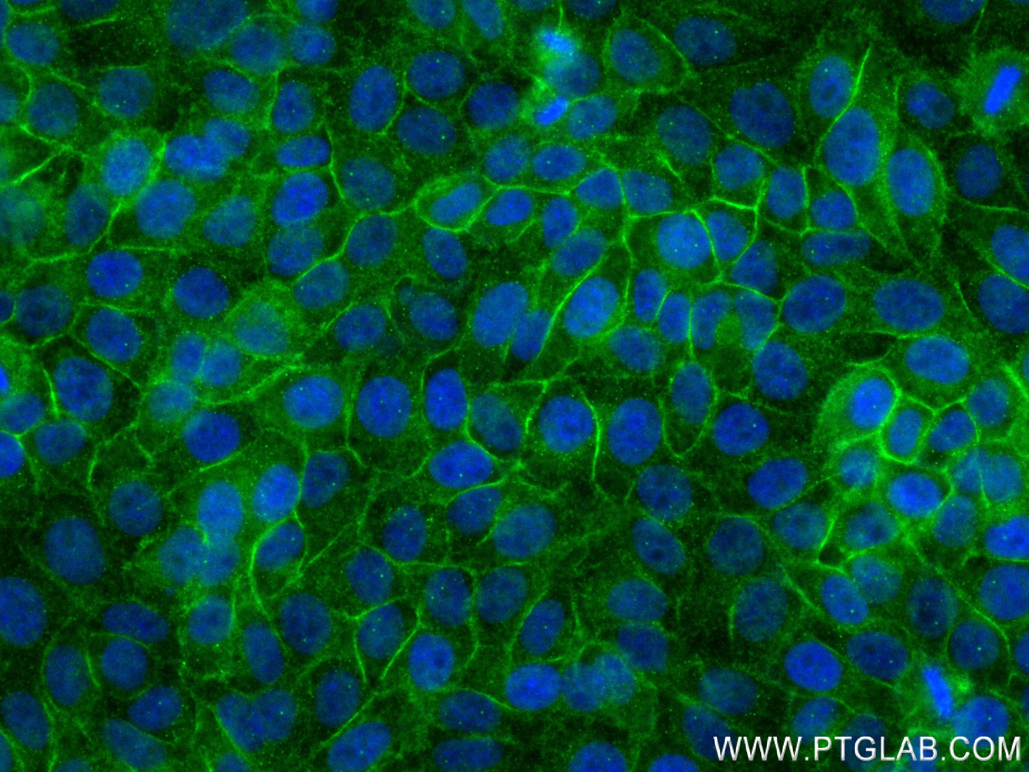 Immunofluorescence (IF) / fluorescent staining of HepG2 cells using SLC31A1 Recombinant antibody (83844-6-RR)