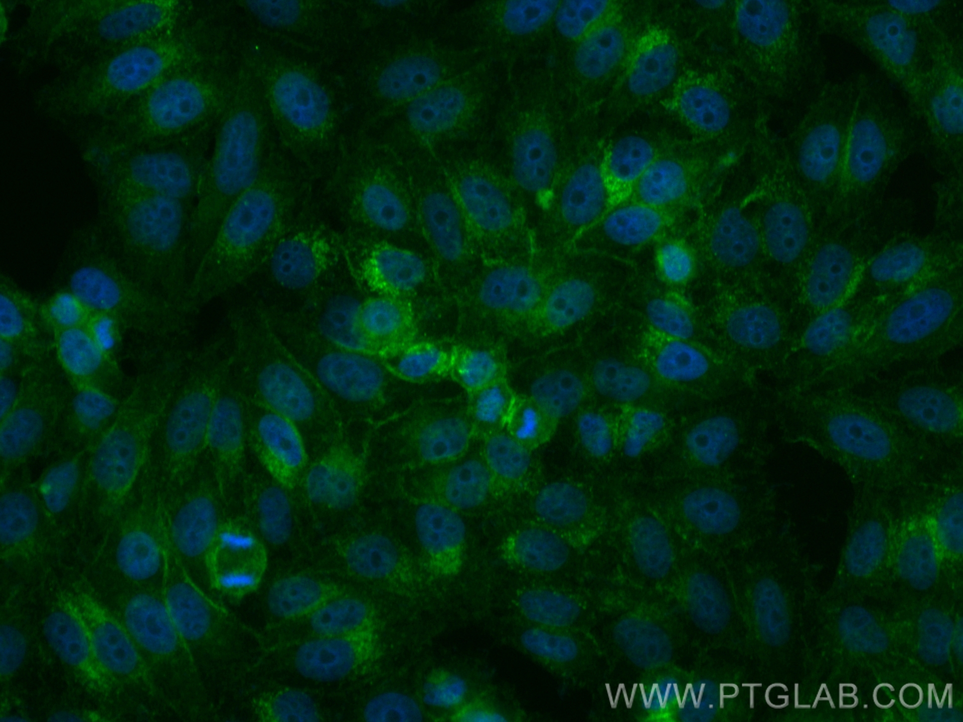 Immunofluorescence (IF) / fluorescent staining of HepG2 cells using CoraLite® Plus 488-conjugated SLC31A1 Recombinant  (CL488-83844-6)