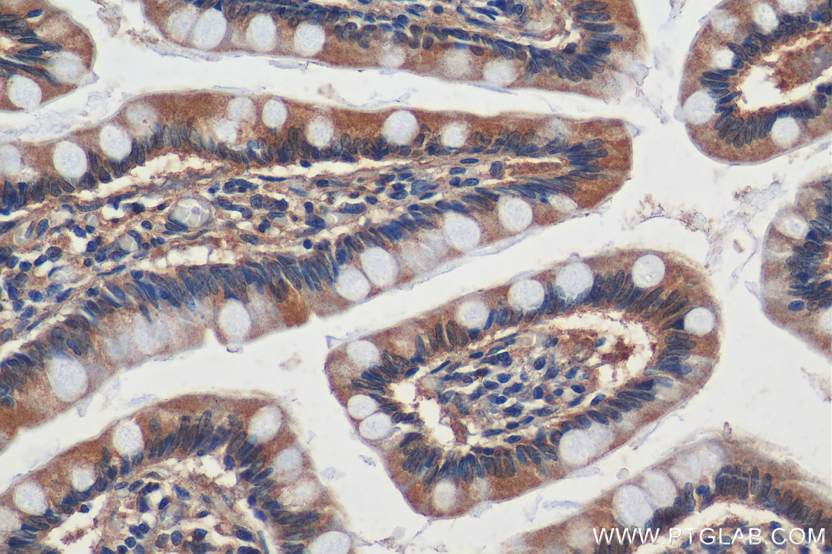 Immunohistochemistry (IHC) staining of human small intestine tissue using SLC36A1 Polyclonal antibody (24775-1-AP)