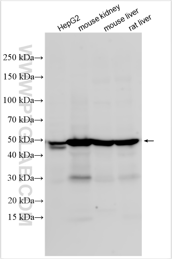 Western Blot (WB) analysis of various lysates using SLC37A4 Polyclonal antibody (20612-1-AP)