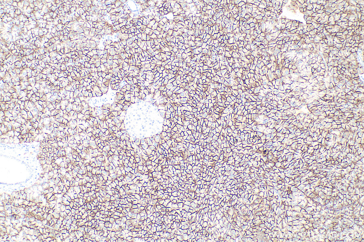 Immunohistochemistry (IHC) staining of mouse pancreas tissue using SLC38A5 Polyclonal antibody (28102-1-AP)