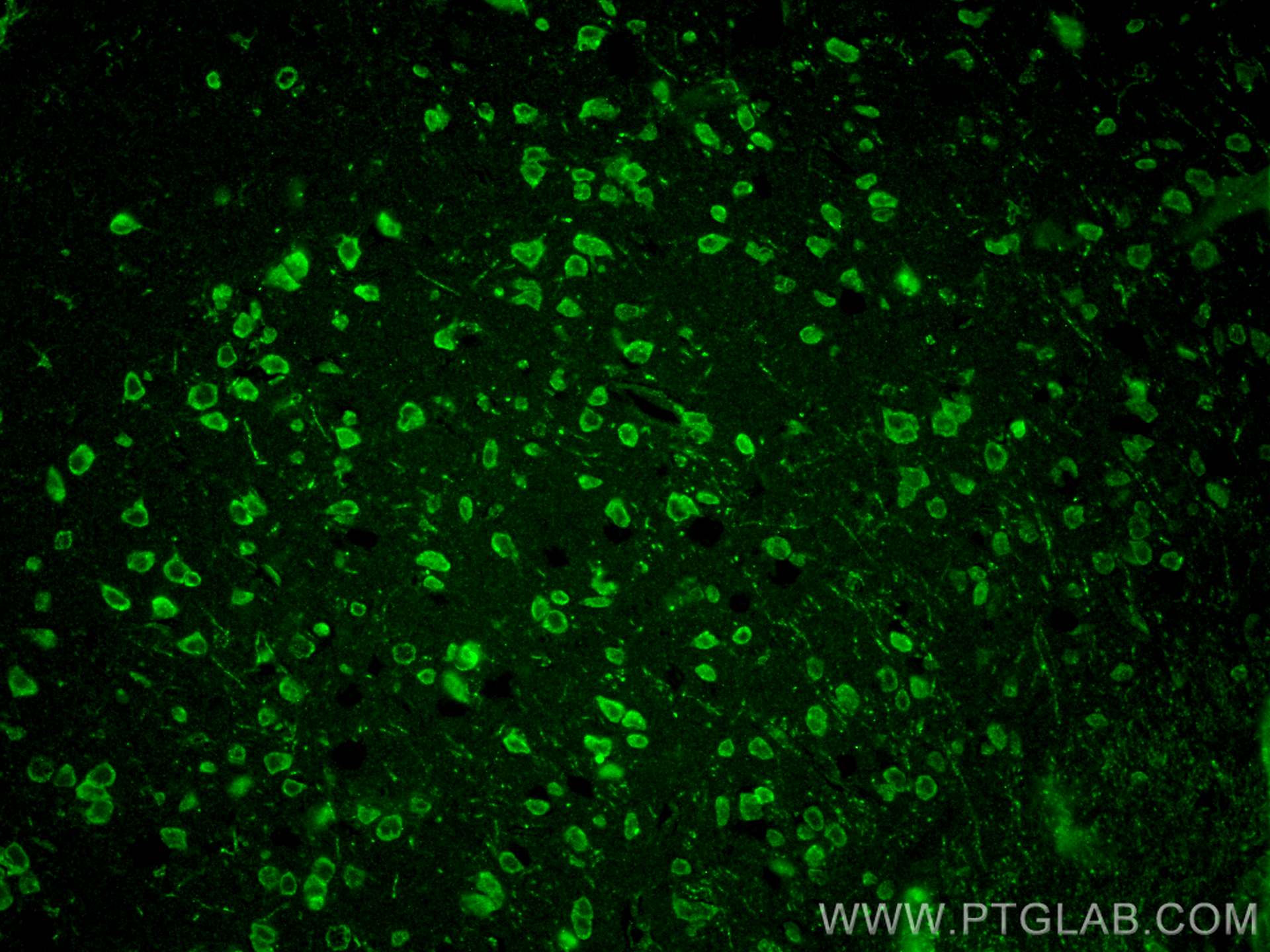 Immunofluorescence (IF) / fluorescent staining of mouse brain tissue using SLC38A6 Polyclonal antibody (27636-1-AP)