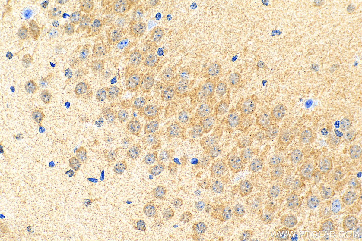 Immunohistochemistry (IHC) staining of mouse brain tissue using SLC38A7 Polyclonal antibody (31486-1-AP)