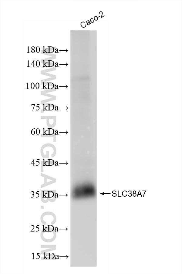 Western Blot (WB) analysis of Caco-2 cells using SLC38A7 Recombinant antibody (83346-6-RR)