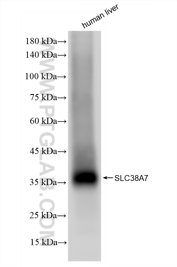 Western Blot (WB) analysis of human liver tissue using SLC38A7 Recombinant antibody (83346-6-RR)