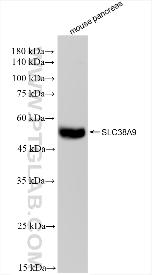 Western Blot (WB) analysis of mouse pancreas tissue using SLC38A9 Recombinant antibody (83182-5-RR)