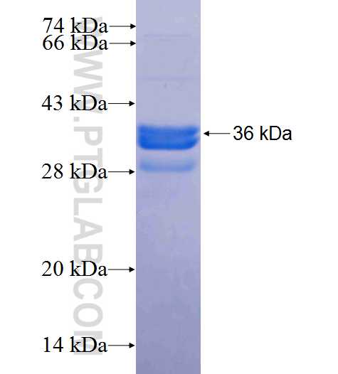 SLC39A1 fusion protein Ag24937 SDS-PAGE