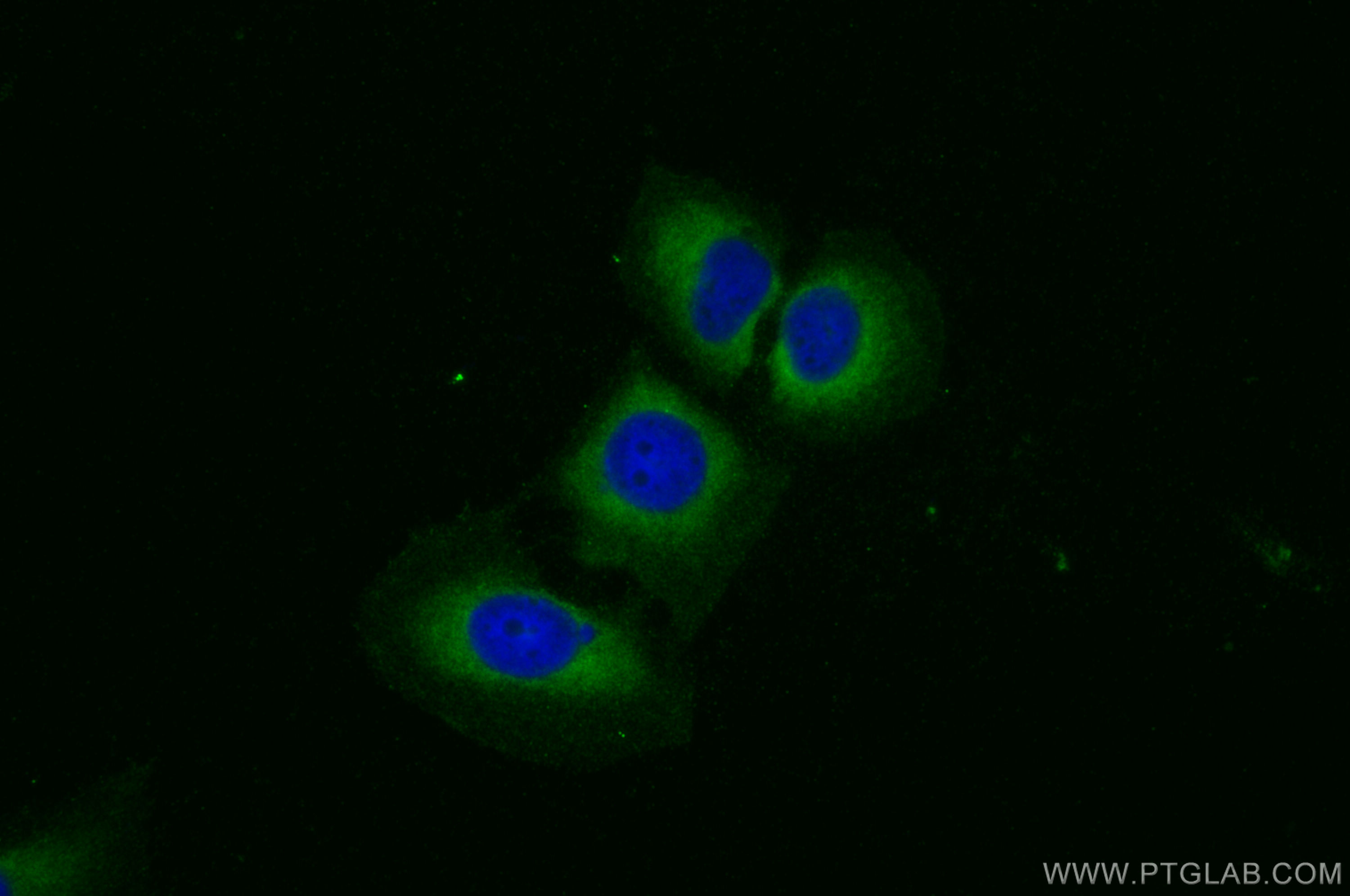 Immunofluorescence (IF) / fluorescent staining of U2OS cells using SLC39A14/ZIP-14 Polyclonal antibody (26540-1-AP)