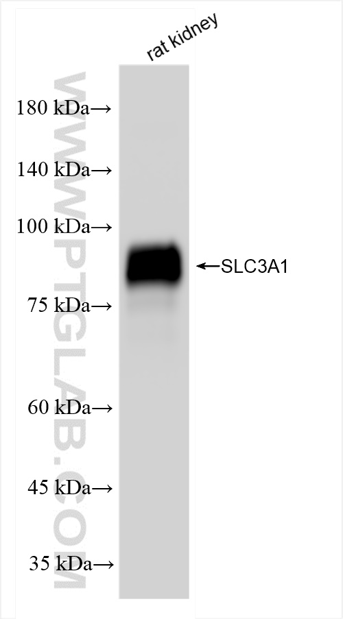 Western Blot (WB) analysis of rat kidney tissue using SLC3A1 Recombinant antibody (84856-2-RR)