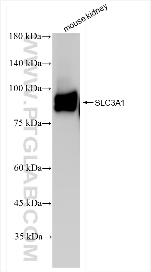 Western Blot (WB) analysis of mouse kidney tissue using SLC3A1 Recombinant antibody (84856-2-RR)