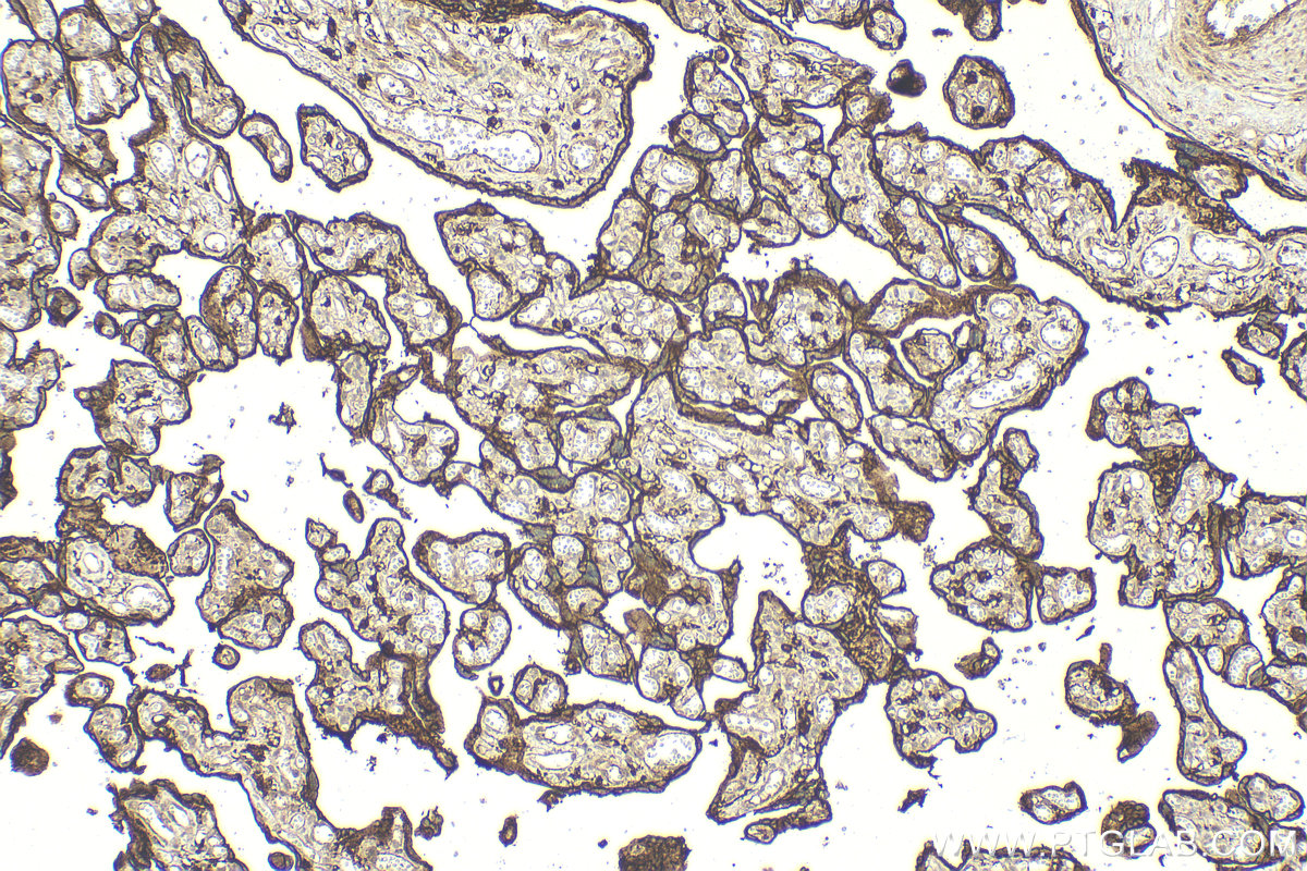 Immunohistochemistry (IHC) staining of human placenta tissue using CD98/SLC3A2 Polyclonal antibody (15193-1-AP)
