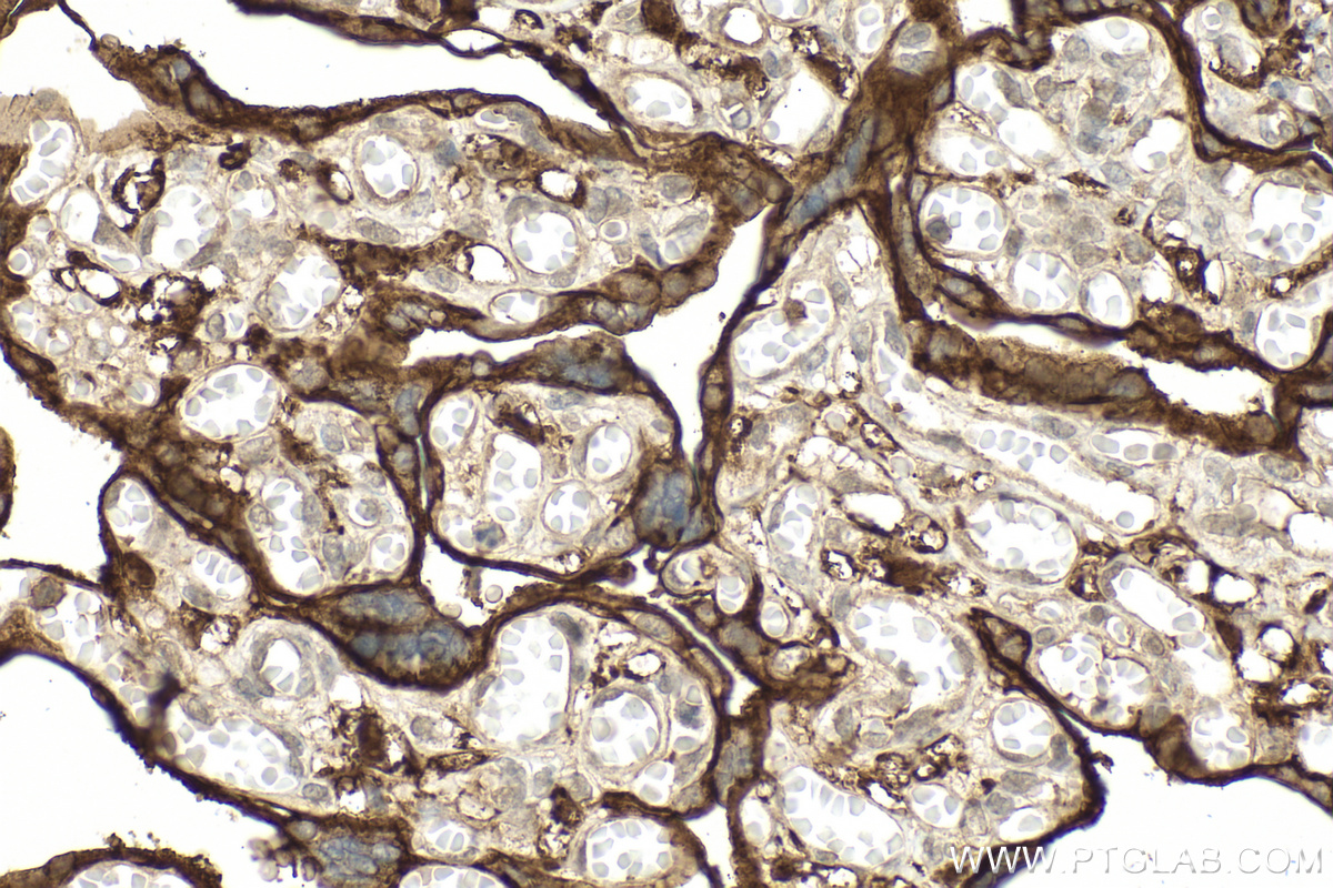 Immunohistochemistry (IHC) staining of human placenta tissue using CD98/SLC3A2 Polyclonal antibody (15193-1-AP)