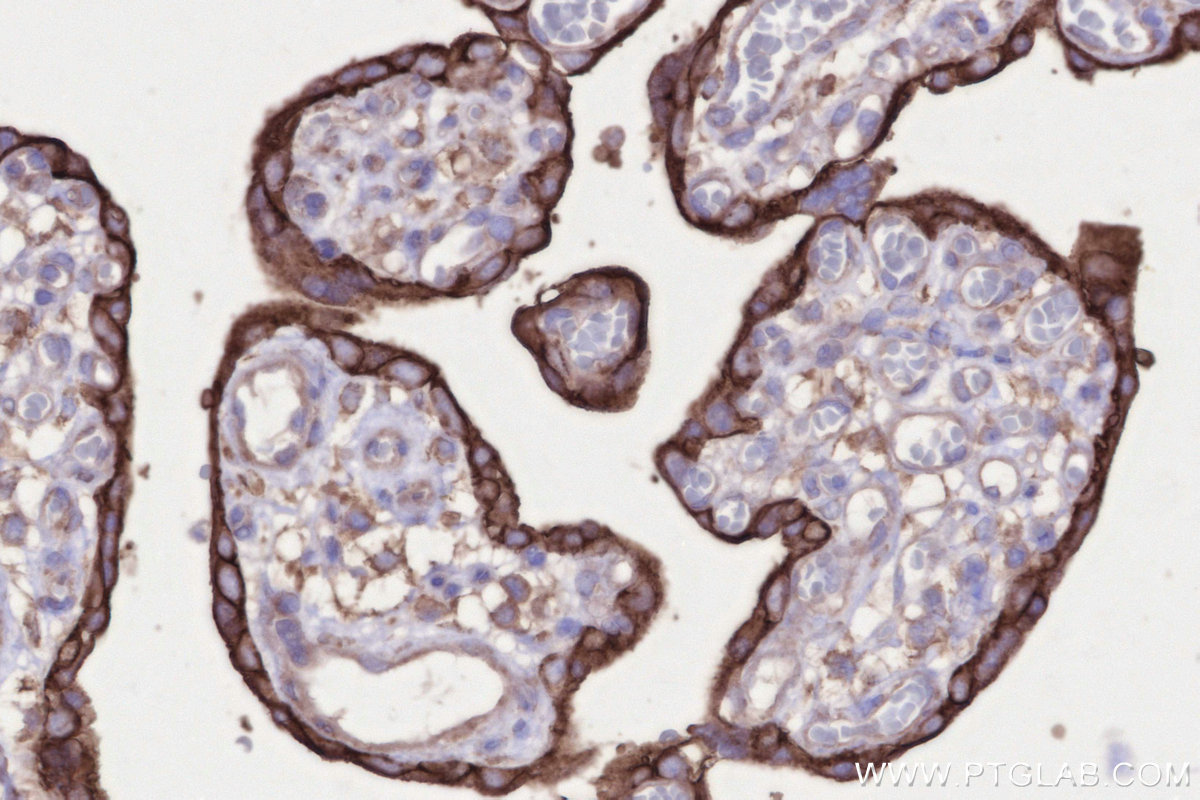 Immunohistochemistry (IHC) staining of human placenta tissue using SLC43A2 Polyclonal antibody (30031-1-AP)