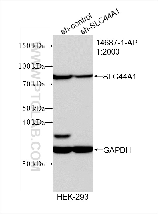 Western Blot (WB) analysis of HEK-293 cells using SLC44A1 Polyclonal antibody (14687-1-AP)