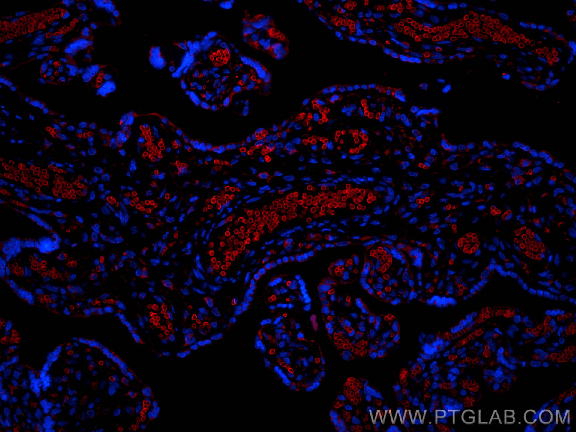 Immunofluorescence (IF) / fluorescent staining of human placenta tissue using Band 3/AE 1 Recombinant antibody (81066-1-RR)