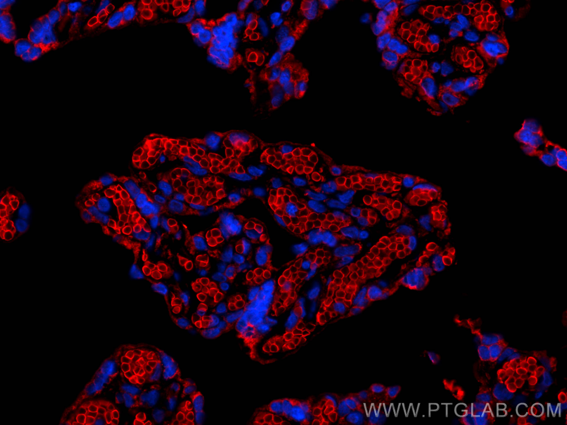 Immunofluorescence (IF) / fluorescent staining of human placenta tissue using Band 3/AE 1 Recombinant antibody (81066-1-RR)