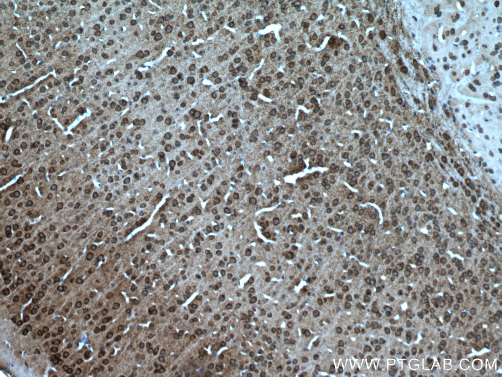 Immunohistochemistry (IHC) staining of mouse brain tissue using SLC4A10 Polyclonal antibody (27197-1-AP)