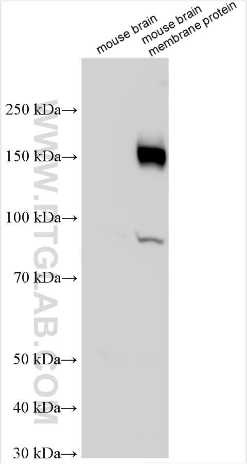 Western Blot (WB) analysis of various lysates using SLC4A10 Polyclonal antibody (27197-1-AP)